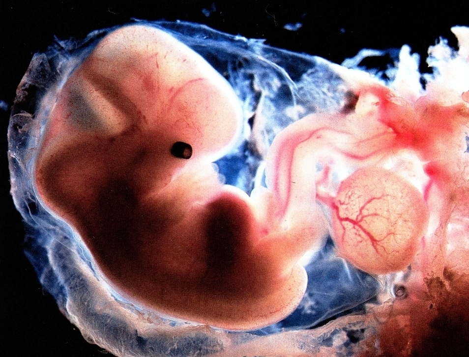 pregnancy embryo | Anatomy System - Human Body Anatomy diagram and