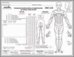 ASIA scale 571 Diagram