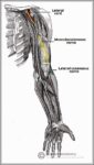 Anatomical Course of the Musculocutaneous Nerve Diagram