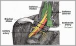 Anatomical Course of the Subclavian Artery Diagram