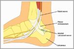 Anatomy of the Medial Calcaneal Nerve Diagram