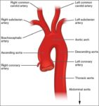 Aorta