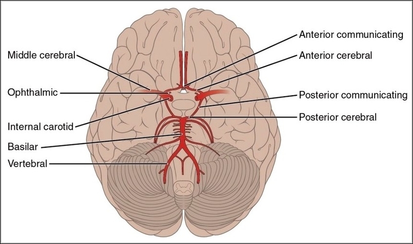 Arteries of the Brain