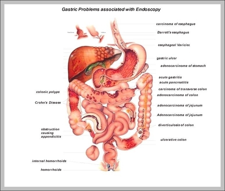 Body Chart Organs Image