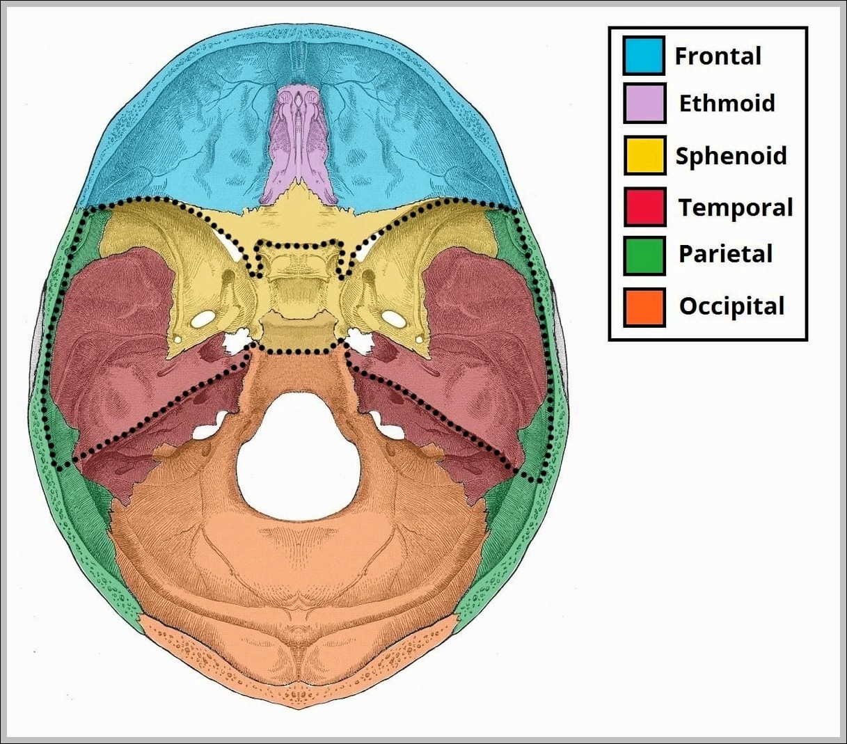 Bones of the Middle Cranial Fossa Diagram