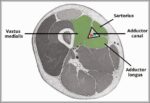 Borders and Contents of the Adductor Canal. Diagram