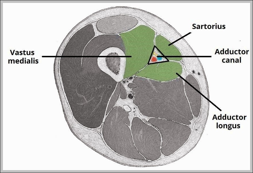 Borders and Contents of the Adductor Canal. Diagram