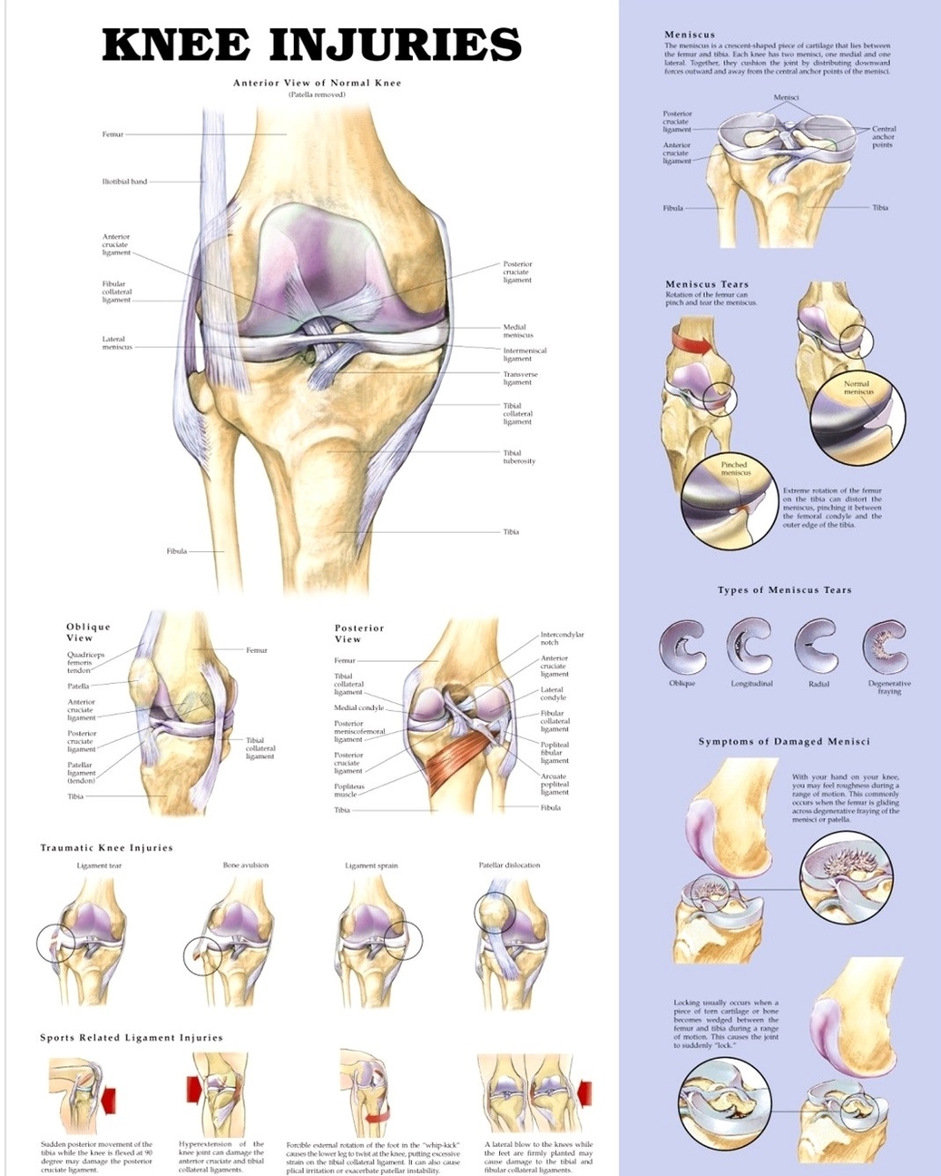 Common Knee Injuries Diagram