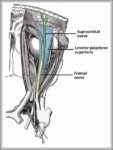 Course of the Supraorbital Nerve Diagram