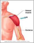 Deltoid Muscle Innervation Image