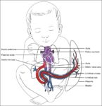 Fetal Circulation