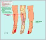 Flexor Digitorum Longus Image