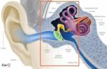 Hearing Aid Diagram Definition