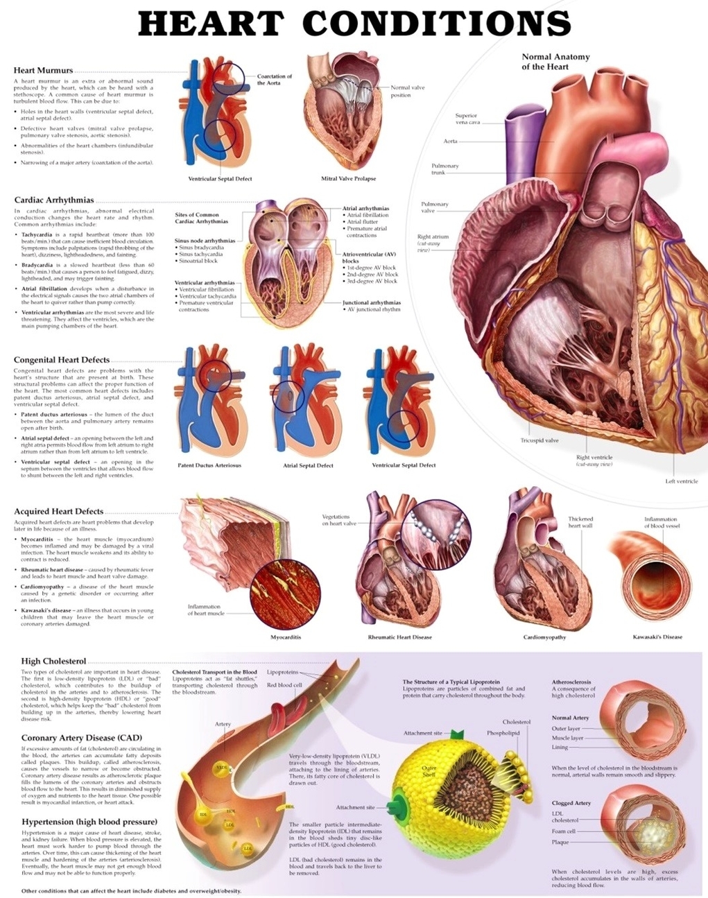 Heart conditions diagram