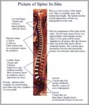 Human Back Anatomy Image