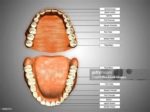 Human Teeth Structure