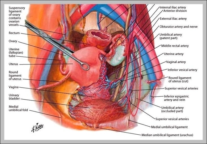 Hypogastric Artery Image
