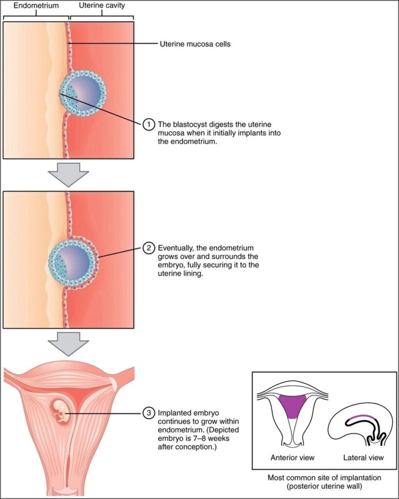 Implantation