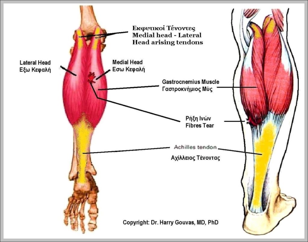 Lateral Gastrocnemius Image | Anatomy System - Human Body Anatomy ...