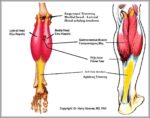 Lateral Gastrocnemius Image