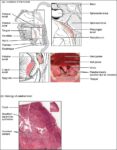 Location and History of Tonsils