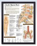 Low back pain causes diagram