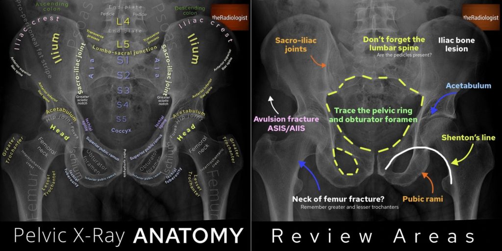 Male Pelvis X Rayap Hip X Ray