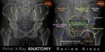 Male Pelvis X Rayap Hip X Ray