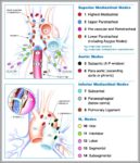 Mediastinal Nodes Image