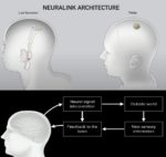 Neuralink diagram how it works