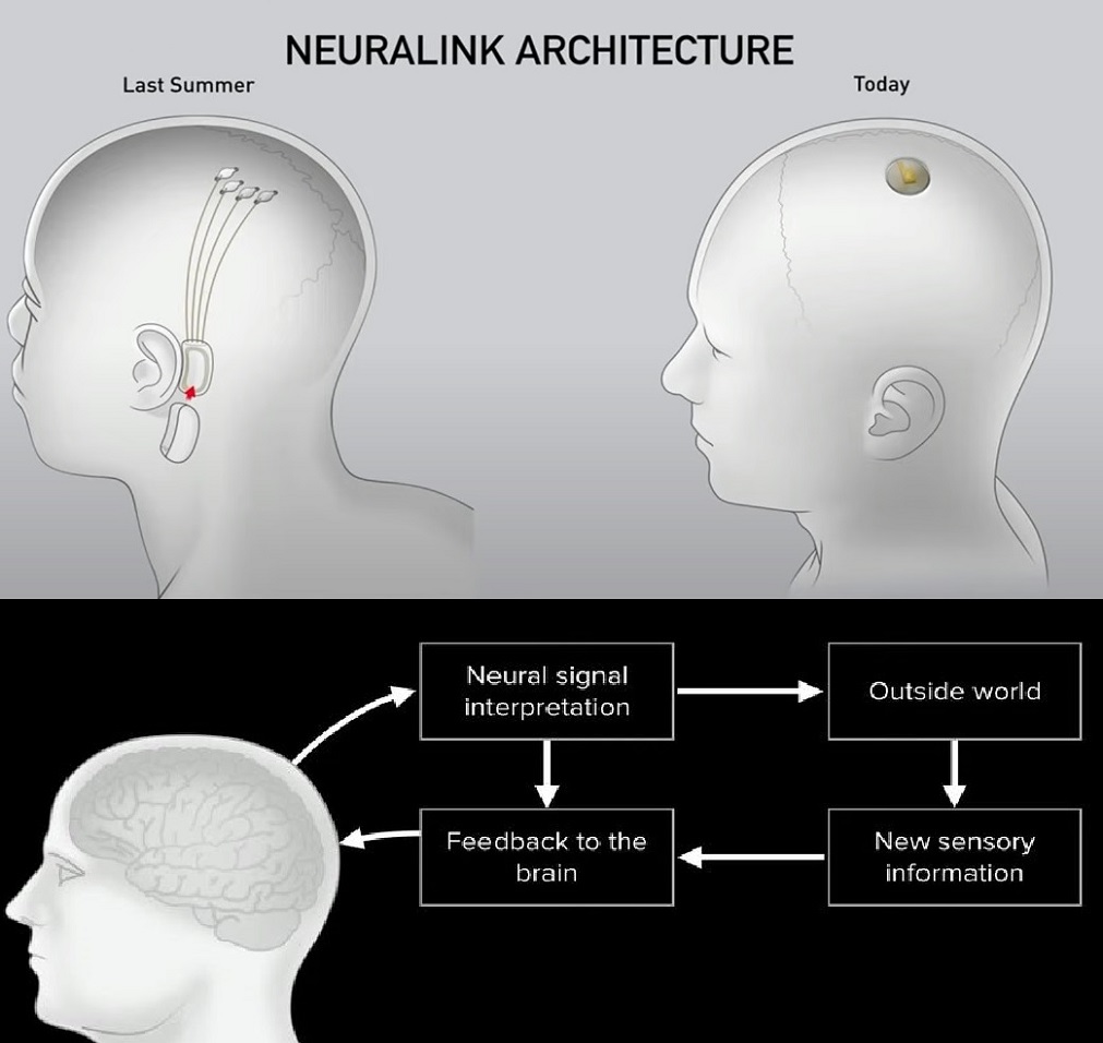 Neuralink diagram how it works