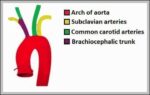 Origin of the Blood Supply to the Upper Limb Subclavian Vessels Diagram