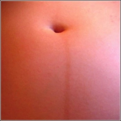 Photo of Linea Nigra