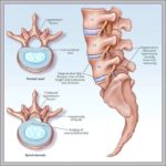 Picture Lumbar Spine Image