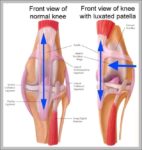 Picture Of A Knee Cap Image