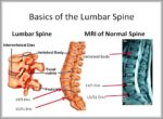 Pictures Of Lumbar Spine Image