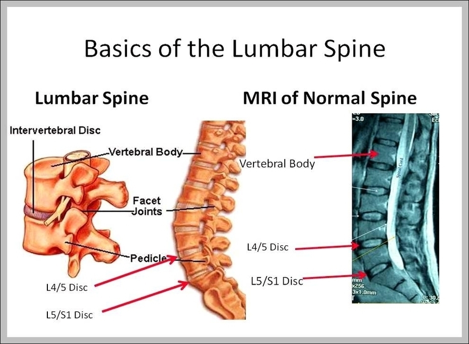 Pictures Of Lumbar Spine Image