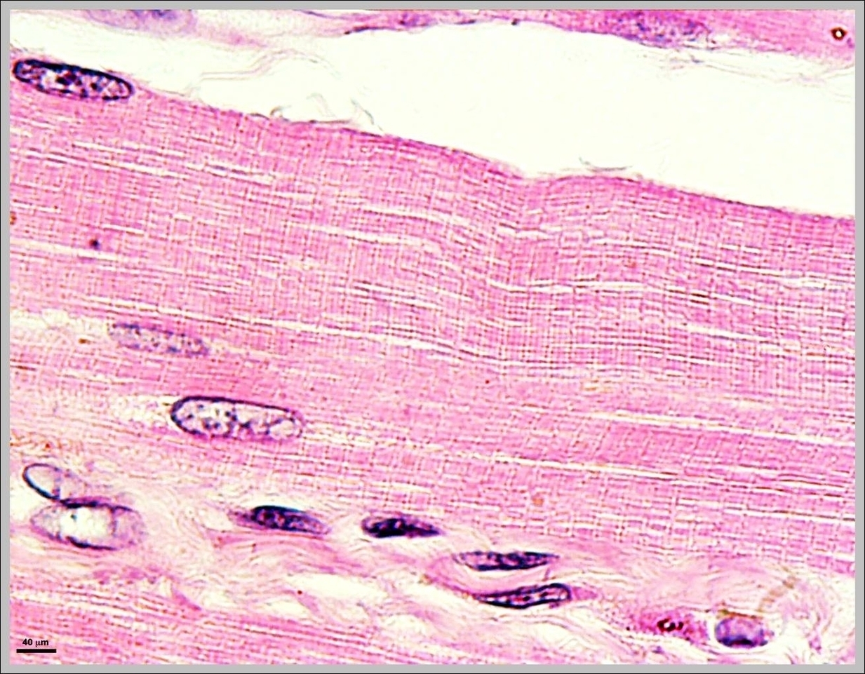 Skeletal Muscle Picture 2 Image