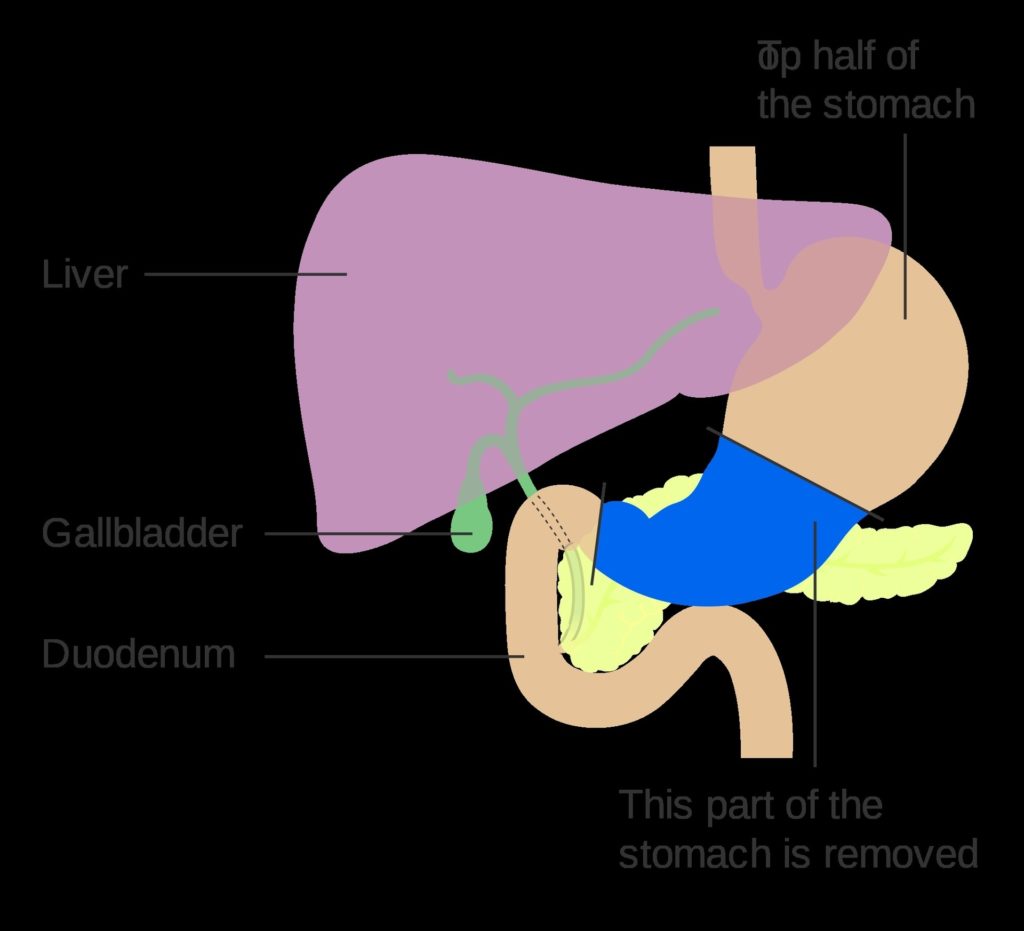 Stomach Diagram Explained