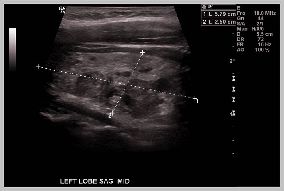 Ultrasound Degrees Image