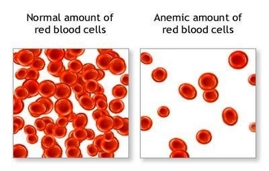 anemia red blood cells