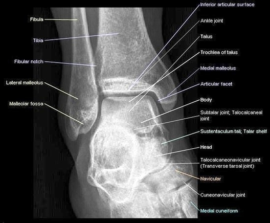 ankle anterior view radiograph large