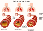 asthma airways