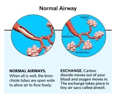 asthma attack anatomy