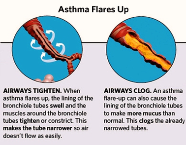 asthma attack steps