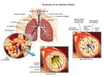 asthma explained