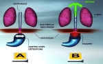 asthma explained1