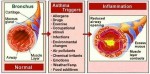 asthma triggers