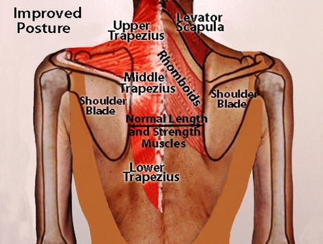 back posture diagram