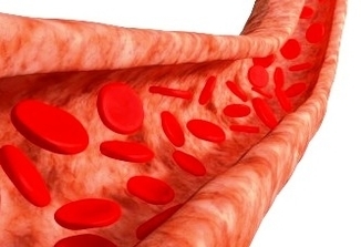 can high blood pressure cause blood in urine